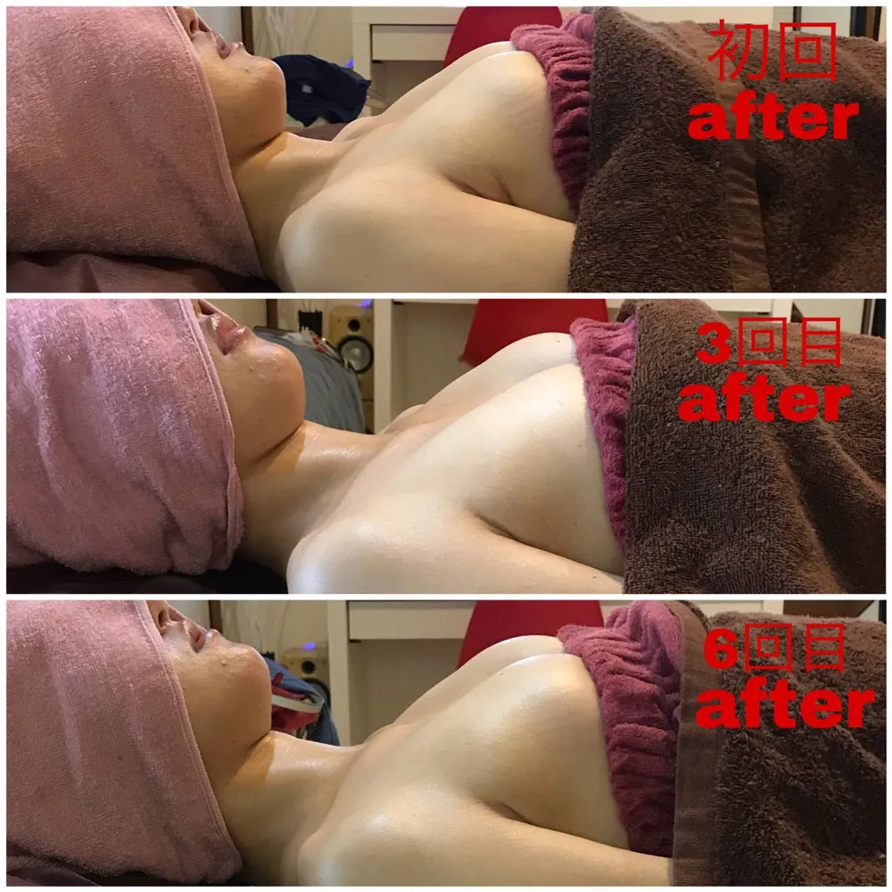 Before＆After